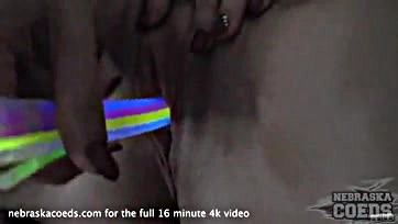 Lady exposes vulva, engorged genitalia