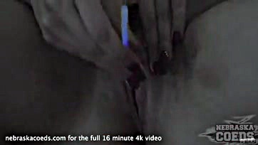 Lady exposes vulva, engorged genitalia