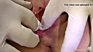 Kristyna's vulva exposed at kinky gynecology examination