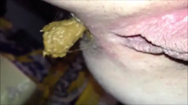 Hairy butthole woman shitting closeup