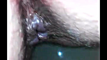 Filthy rectum examined by advanced medical endoscopic technology