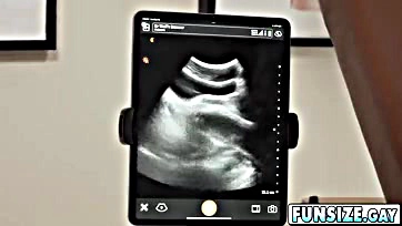 Doctor performs intense ultrasound on patient's split cock